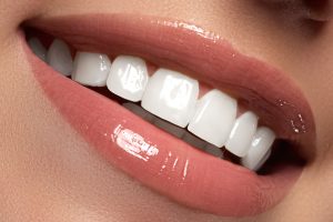 beneficios da ortodontia para o sorriso